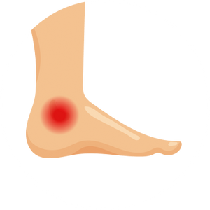 Foot